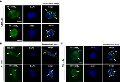 Dimerization of GPCRs: Novel insight into the role of FLNA and SSAs regulating SST2 and SST5 homo- and hetero-dimer formation